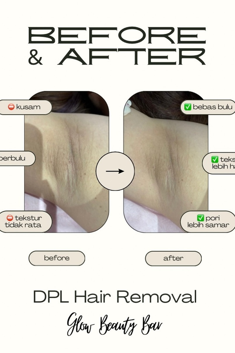 Glow Beauty Experience 11